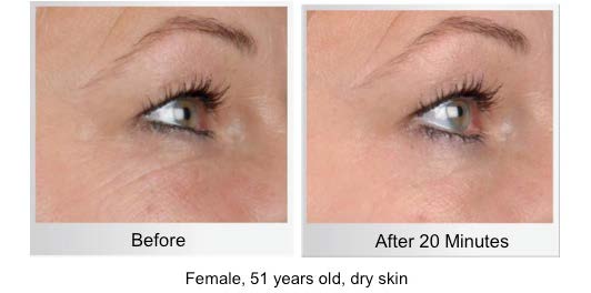 INSIGHT COLLAGEN EYE TREATMENT MASKS